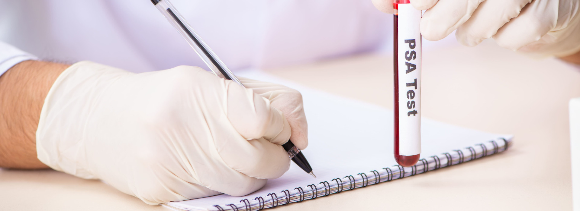 Valori psa: quando sono nella norma