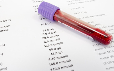 Linea guida su come leggere gli esami del sangue