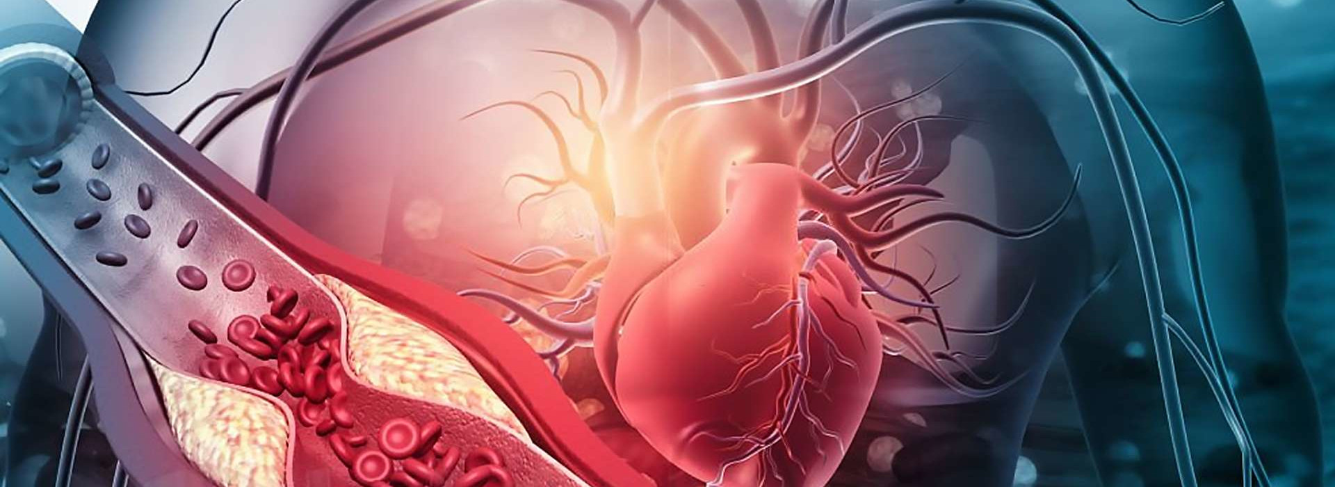Ridurre il colesterolo LDL anche negli over 70 è possibile per prevenire gli eventi cardiovascolari