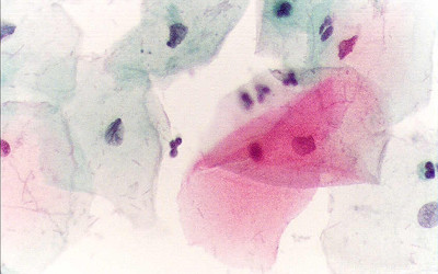 L'importanza del Pap Test: prevenzione e salute al femminile