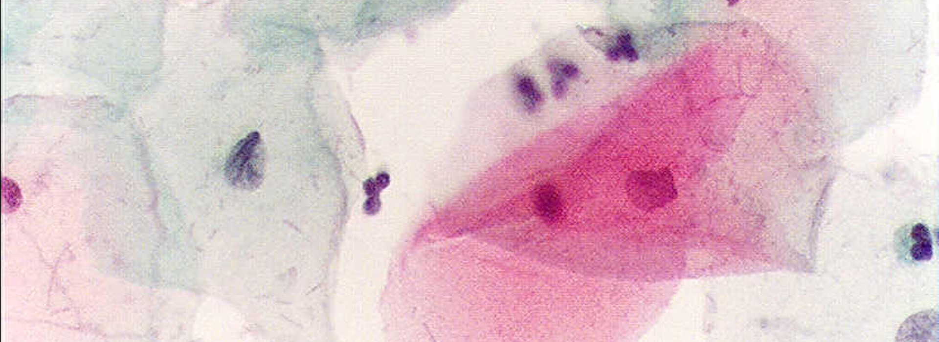 L'importanza del Pap Test: prevenzione e salute al femminile