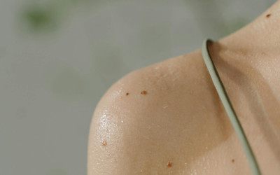 Tumori della pelle: prevenzione, diagnosi precoce e cura: guida completa per comprendere, proteggere e intervenire